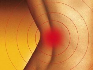 Lower back with osteochondrosis